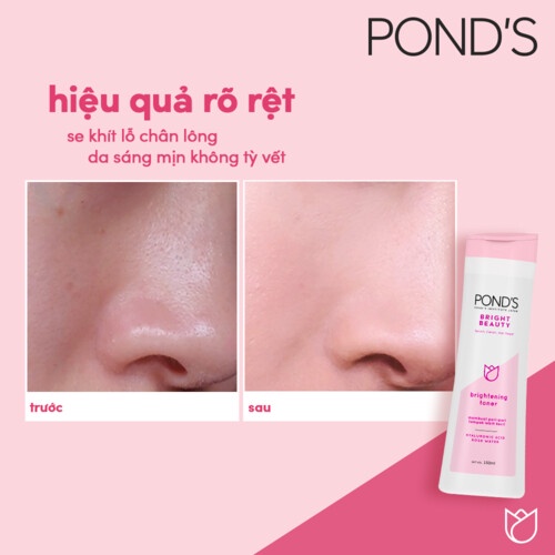 Nước hoa hồng POND'S White Beauty sáng da cân bằng pH se khít lỗ chân lông 150ml