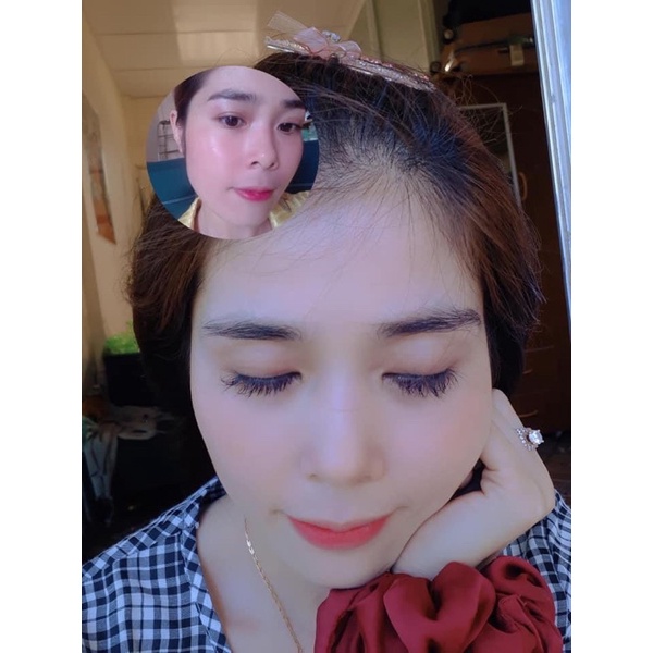 Dưỡng dài mi Phương Anh - Dưỡng mi Yody White Phương Anh