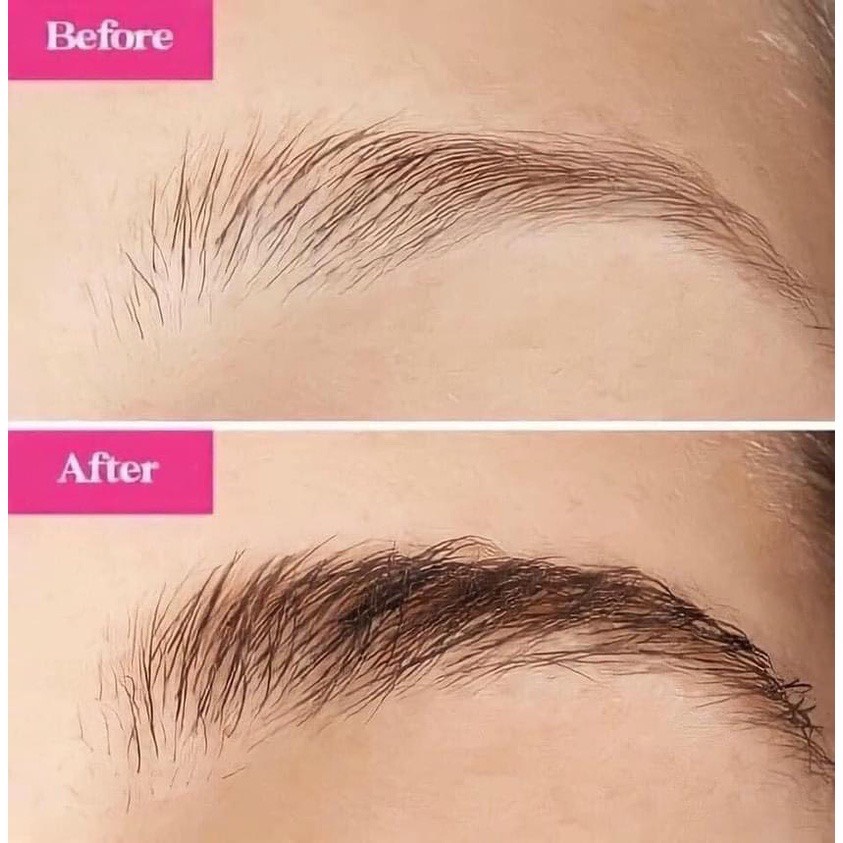 Dưỡng Mi GrandeLASH-MD & Serum Dưỡng Mọc Lông Mày Grandebrow Brow Enhancing