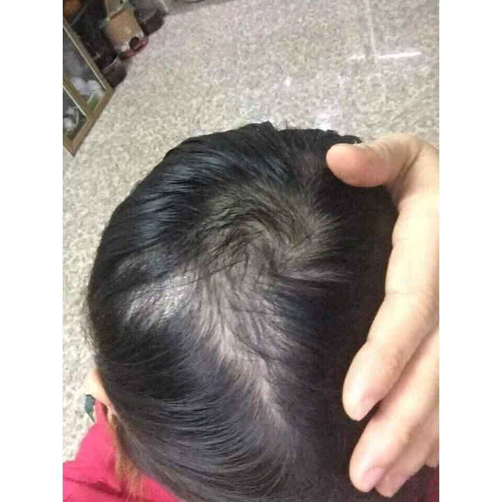 Xịt mọc tóc Đinh Hương Nhu giúp mọc tóc nhanh hơn dài hơn mượt hơn 120ml