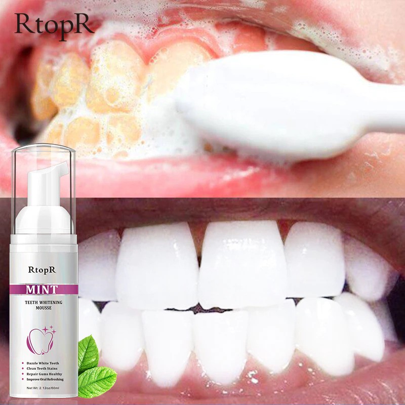 RtopR Bọt Tẩy Trắng Răng Làm Sạch Răng Khử Mùi Hôi Miệng Mousse Teeth Whitening Clean Teeth 60ml