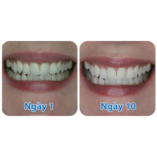 Kem Đánh Răng Oral 3D White