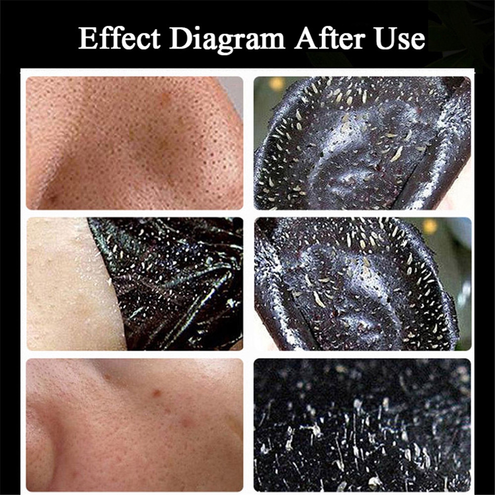 1 cái ★ ★ Mặt nạ bùn núi lửa lột mụn đầu đen se khít lỗ chân lông | BigBuy360 - bigbuy360.vn