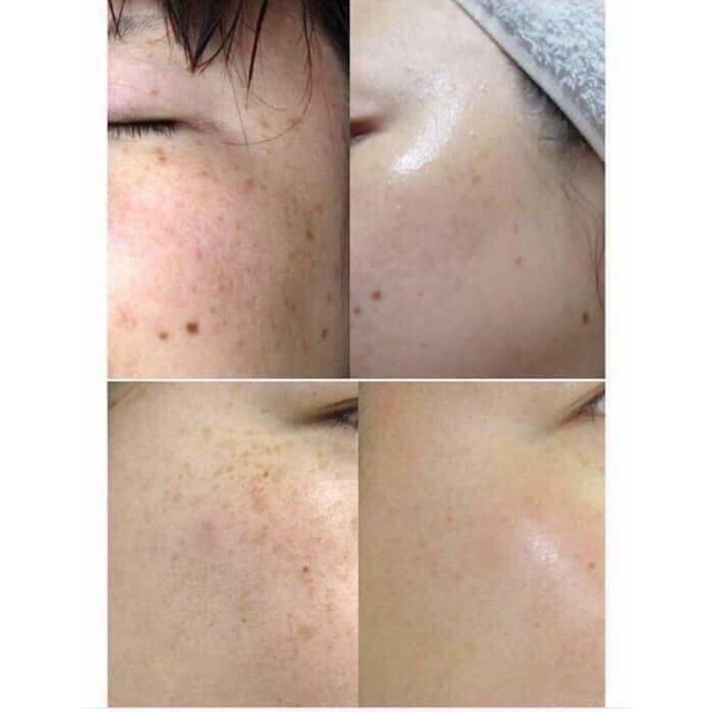 Kem Nám Và Trắng Da DONGSUNG RANNCE CREAM Hàn Quốc 10g