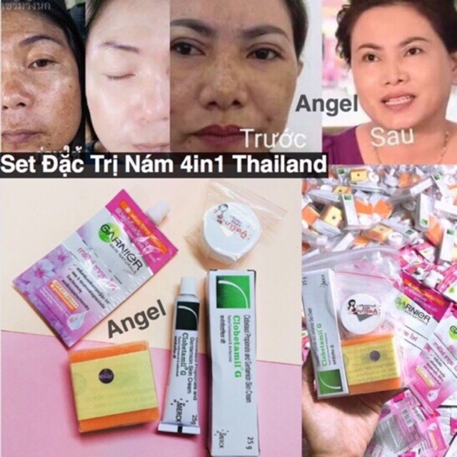 Hết sạch nám, tàn nhang với Garnier của Thái