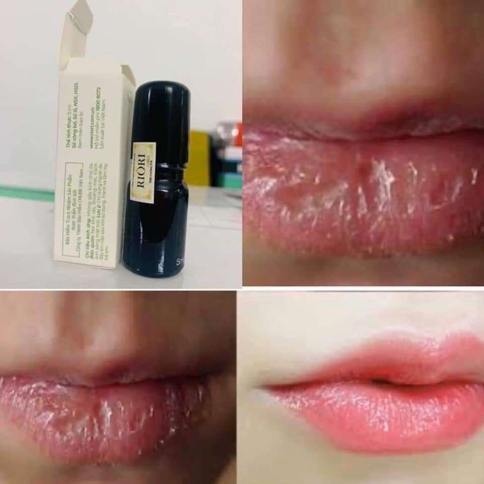 Dưỡng Môi RIORI Lip Serum 5ml - Serum Dưỡng Môi Mềm Mịn Chống Thâm, Cứu tinh cho đôi môi khô, nứt nẻ, bong tróc...