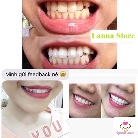 Combo 14 miếng (7 gói/ 7ngày) dán trắng răng Crest 3D White Whitestrips loại Supreme Professional