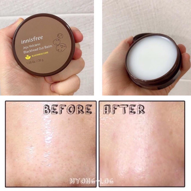 VOLCANIC BLACK HEAD OUT BALM - sáp loại bỏ mụn đầu đen | BigBuy360 - bigbuy360.vn