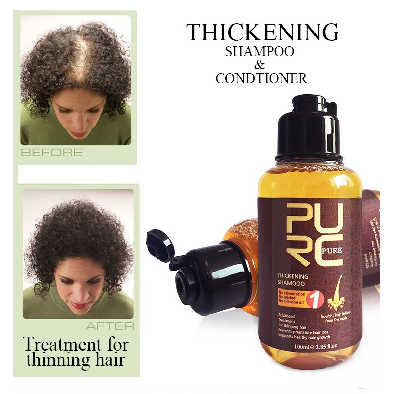 Bộ Sản Phẩm PURC Gồm Tinh Dầu Kích Mọc Tóc 20ml Kèm Dầu Gội Gừng 100ml