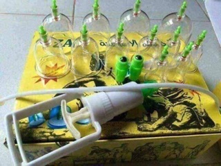 Bộ giác hơi 12 chi tiết