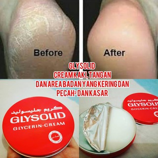 [HOT] KEM DƯỠNG GLYSOLID HAUTBALSAM  ĐẶC TRỊ NẺ Á SỪNG