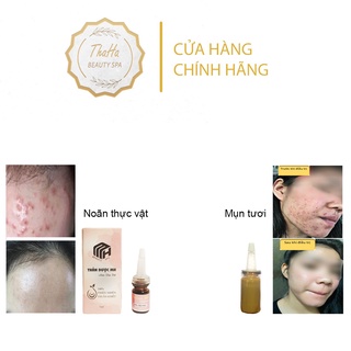 Noãn thực vật MH Beauty Spa, Thần dược MH, 7ml serum giảm mụn, dưỡng phục hồi da, làm dịu da