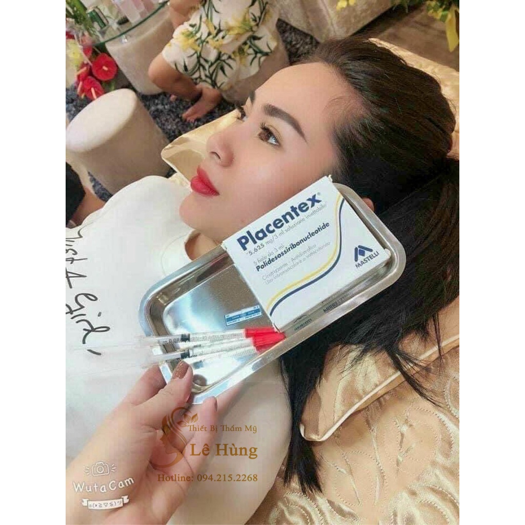 ,DNA cá hồi Placentex, Mastelli Chính Hãng Italy Công Nghệ Trẻ Hóa Làn Da Mới Nhất Hiện Nay