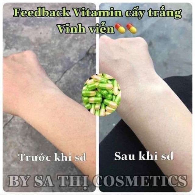 ❀Hola❀  Gói 10 Viên Vitamin Cấy Trắng Sa Thị