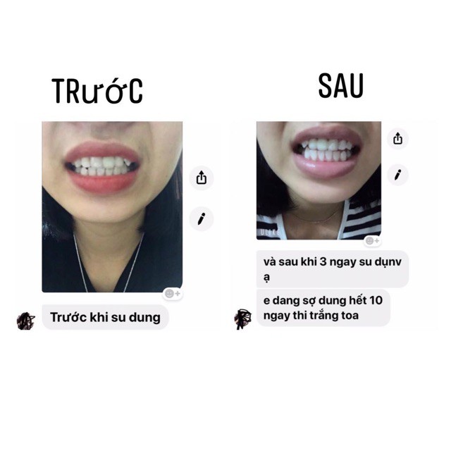 [ 1 GÓI ] Miếng dán trắng răng ❤ FREESHIP ❤  miếng dán Crest 3D White Whitestrips [Hàng Mỹ] - trắng răng Crest 3D White