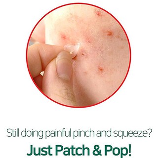 Miếng dán mụn Some By Mi Clear Spot Patch 18 miếng