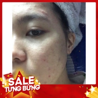 Combo tri mun Dr mai [CHÍNH HÃNG] ✅