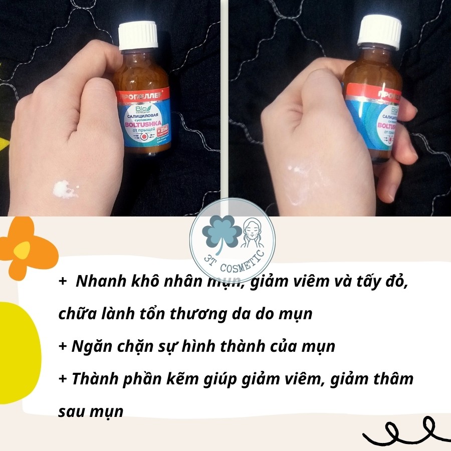 Chấm mụn kẽm PROPELLER, Serum chấm mụn hiệu quả