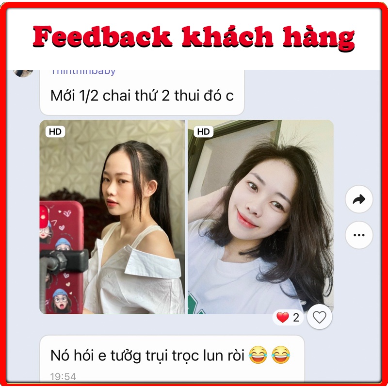 Mọc Tóc Nhanh Chóng - An Toàn. Lọ Xịt Minoxidil Bailleul 2% - Nhập khẩu Pháp. Giảm Rụng Tóc Và Kích Thích Mọc Tóc