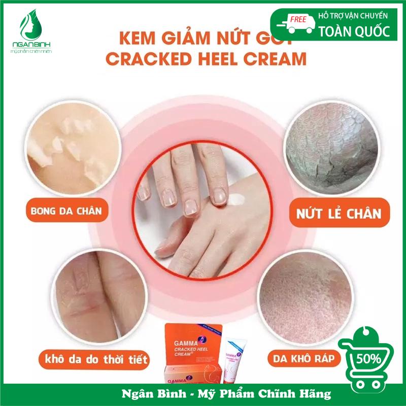 Kem giảm nứt gót chân dưỡng ẩm, dưỡng da chân làm mềm