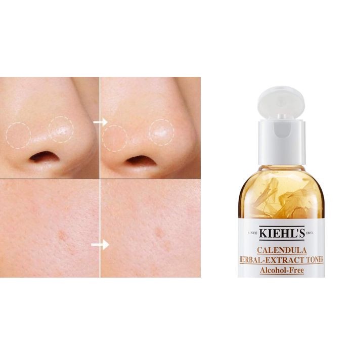 Combo 4 Món Kiehls Hoa Cúc Mini - Sữa Rửa Mặt-Nước Hoa Hồng-Mặt Nạ-Kem Mặt Kiehl's Hoa Cúc