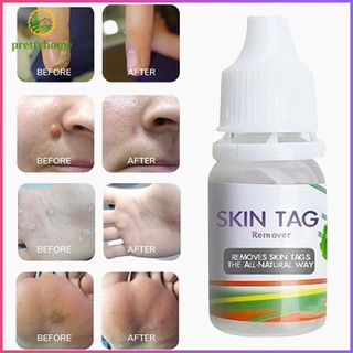 (Hàng Mới Về) Thuốc Mỡ Trị Mụn Cóc Dung Tích 10ml
