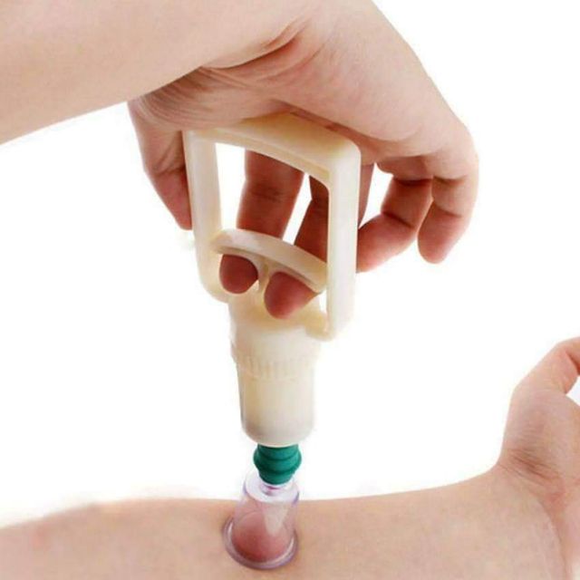 Bộ ống hút mụn máu bầm