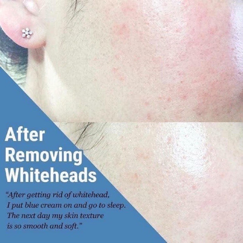 Kem dưỡng Klairs Midnight Blue Calming Cream