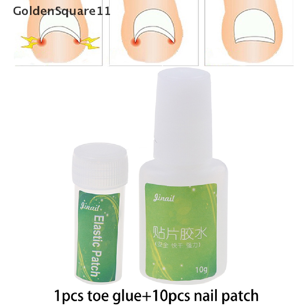 Set 11 Miếng Dán Đàn Hồi Chỉnh Sửa Móng Chân Mọc Ngược Kèm Keo Dán