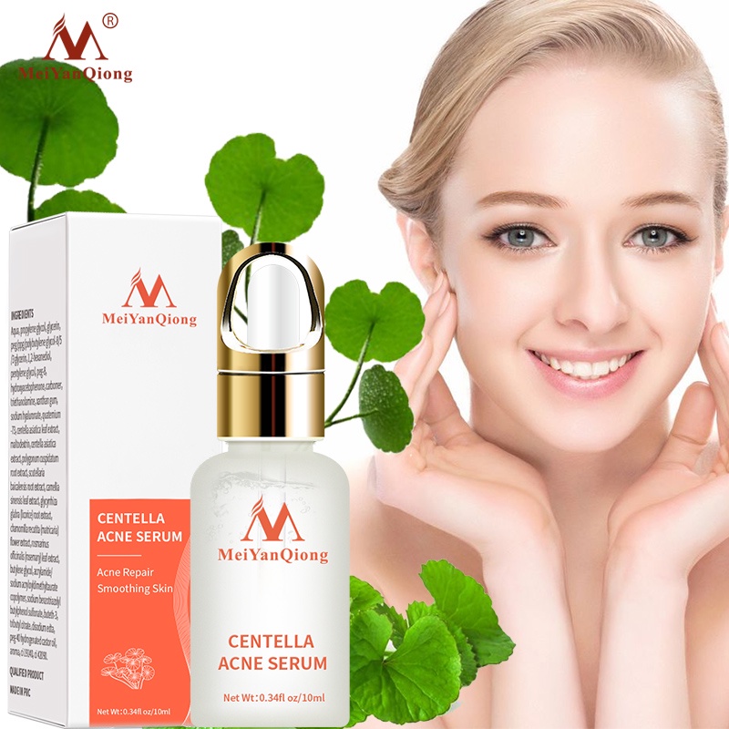 Serum hỗ trợ trị Mụn Trứng Tinh Chất Rau Má MeiYanQiong Kiềm Dầu Và Dưỡng Ẩm 10ml