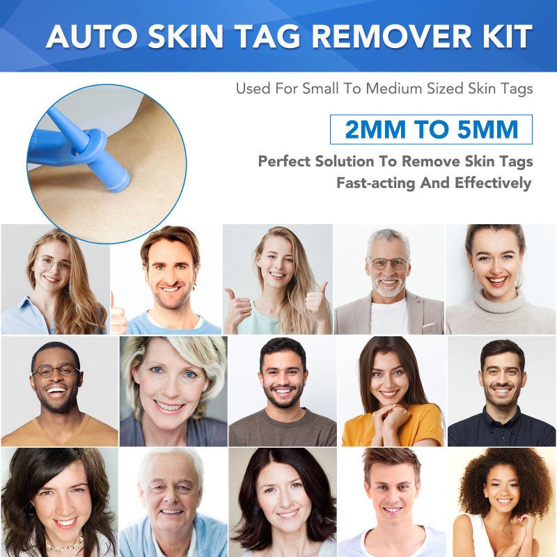 Youyo Bộ Dụng Cụ Loại Bỏ Thẻ Da An Toàn Nhanh Chóng Trong Phút Với Băng Tần Vi Sợi Lau Chùi