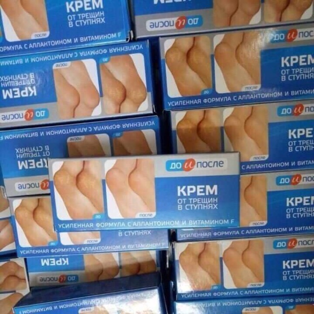 KEM BÔI NỨT GÓT CHÂN