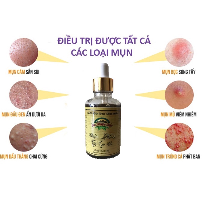 AN DƯỢC SƠN 3 chai Serum tái tạo 30ml - SẠCH MỤN SẠCH NÁM SẸO RỖ