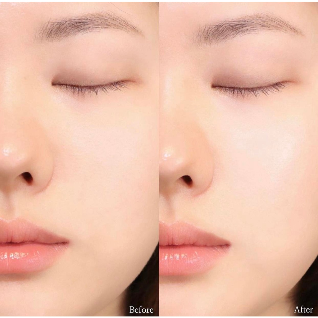 Kem mắt Estee Lauder Advanced Night Repair Eye Complex 15ml