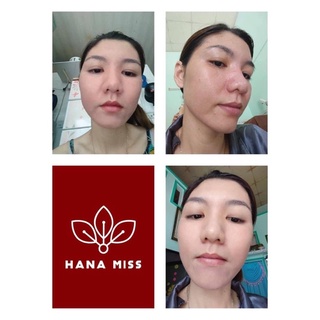 BỘT RỬA MẶT LINH CHI