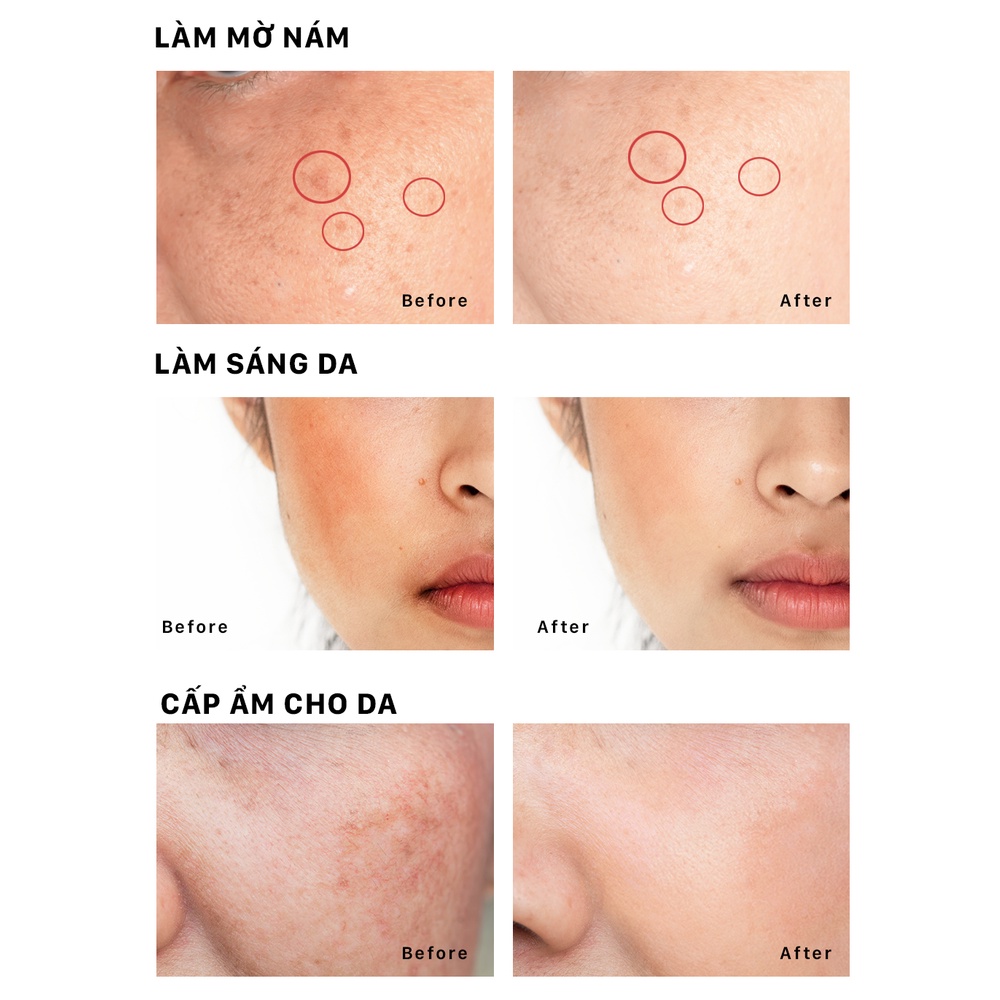 Kem dưỡng mờ nám và tàn nhang OMUSE MelaV Cream 50g