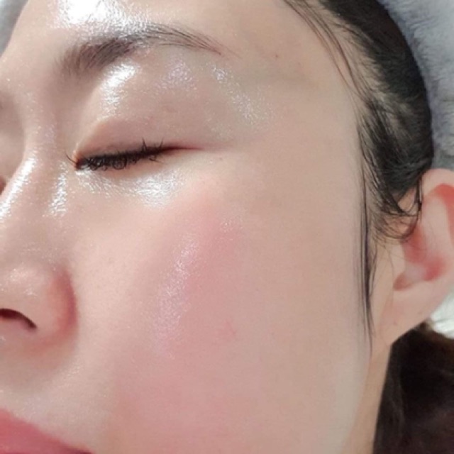 Kem Duỡng Da Trắng Mịn Căng Bóng Forencos Peptide Redensifying Intensive | BigBuy360 - bigbuy360.vn