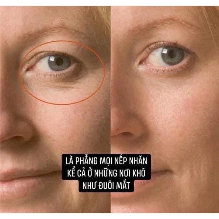 [Mã 254FMCGSALE giảm 8% đơn 500K] Kem dưỡng da Retinal Dr.Different Vita A Cream Forte 0.1 phiên bản mới