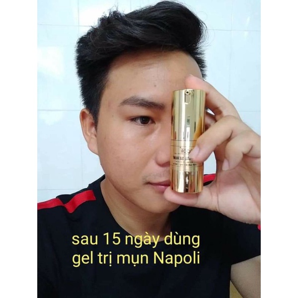 Serum Ngừa Mụn Napoli Hải Âu Việt