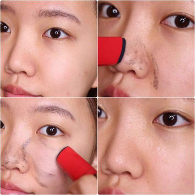 Sáp  RIRE All Kill Blackhead remover stick( the red)