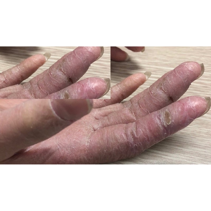 Kem Bôi Ngoài Da Ngừa Nắm Ngúa Nứt Nẻ Tay Chân(Hộp Xanh Trắng)