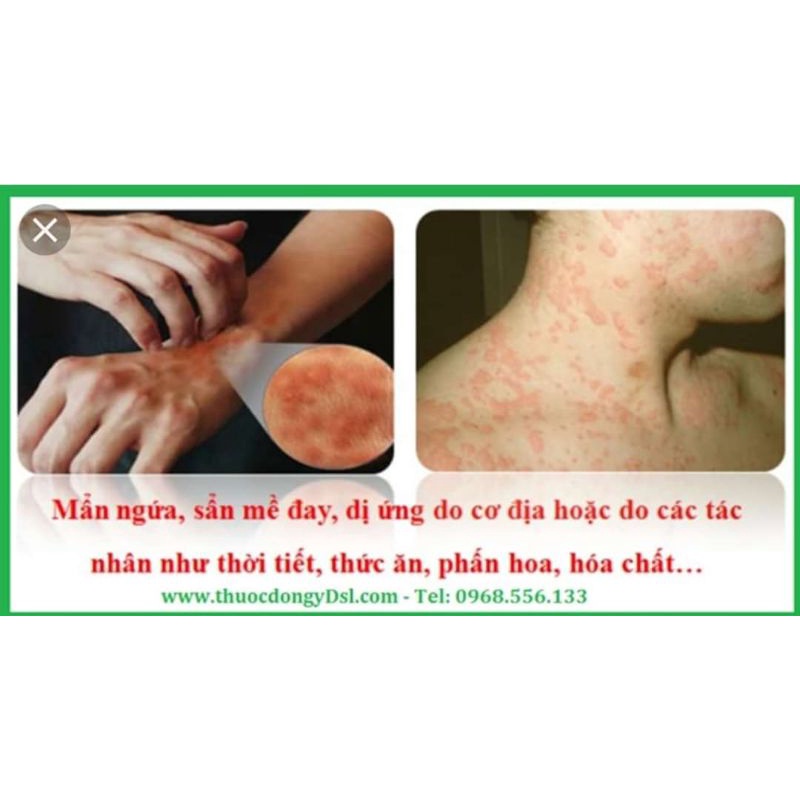 Viên uống bổ gan Anprex Plus