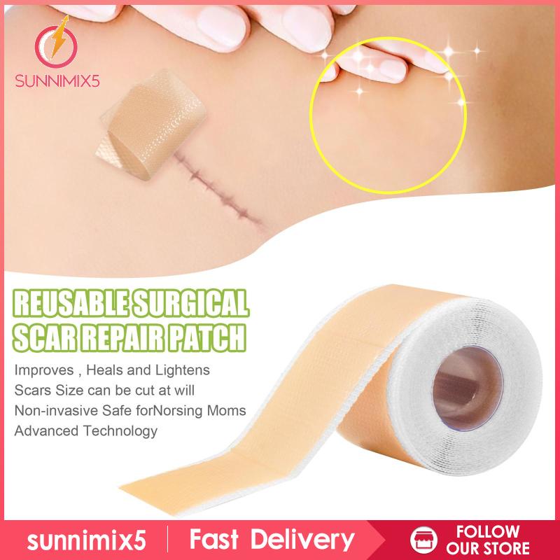 Băng Keo Silicon Mềm Hỗ Trợ Giảm Sẹo Loại Bỏ Sẹo Cho C-Section