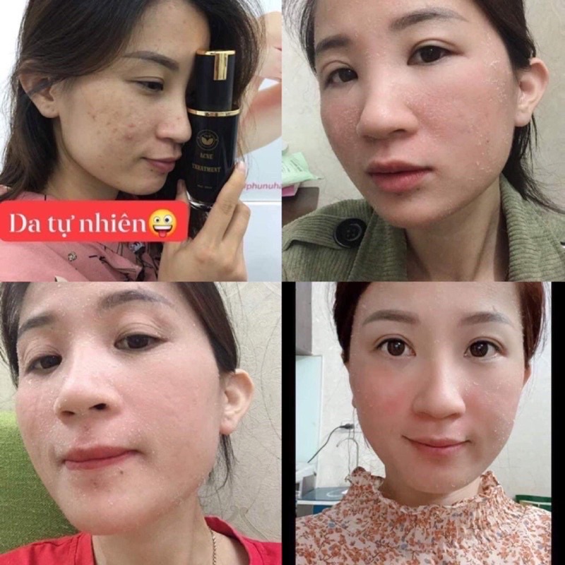 SERUM TÁI TẠO TRẦN KIM HUYỀN