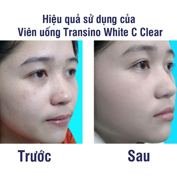 Viên uống trắng da Transino White C Clear hộp 120v viên uống mờ nám sáng da nội địa Nhật