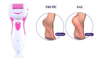 Máy tẩy tế bào gót chân shinon