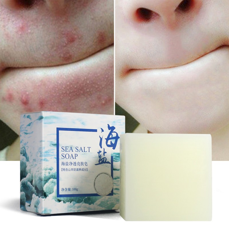 Xà Phòng Muối Biển Cho Mụn Lưng Sea Salt Soap | BigBuy360 - bigbuy360.vn