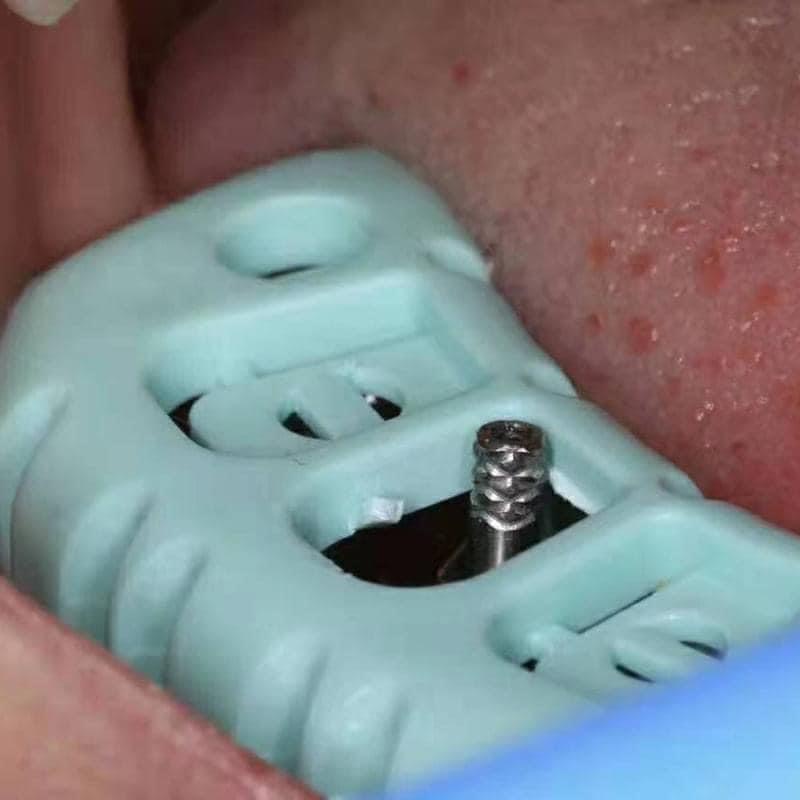 Khay cán gập góc nang hoa chuyên lấy dấu implant