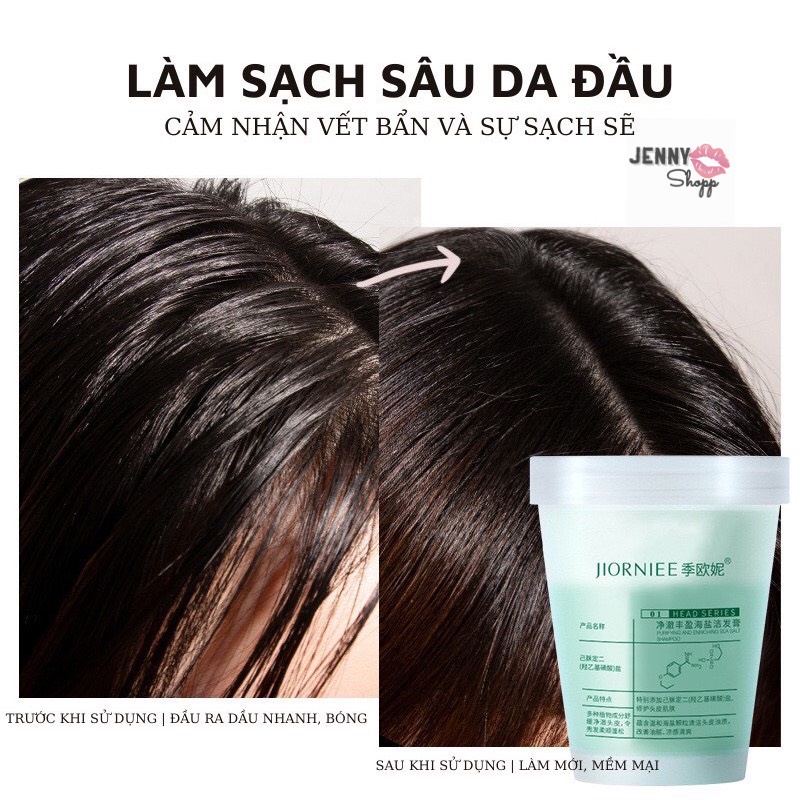 Combo Lược & Tẩy Da Chết Cho Tóc Và Da Đầu Jiorniee Head Series