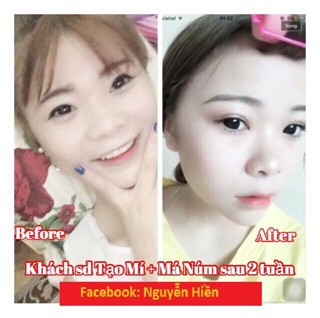 [ FREE SHIP ] Tinh chất tạo mắt 2 mí Pháp